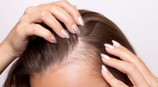 Kobieta przeczesująca palcami włosy i pokazująca przerzedzenia na włosach